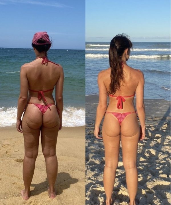 Antes e depois de uma aluna da Crew, glúteo
