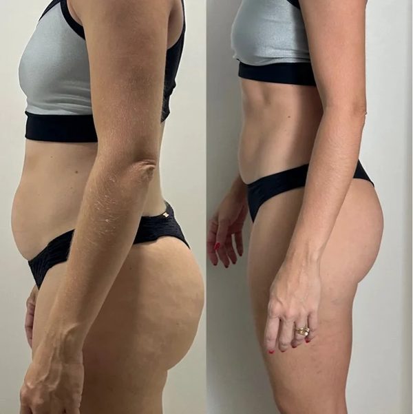 Antes e depois de uma aluna da Crew, perfil