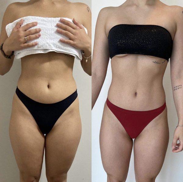 Antes e depois de uma aluna da Crew